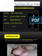 Atrofia Testicular (Expo - Patología)