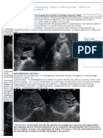 ARTICULO 2 Ecografía de La Vesícula y La Vía Biliar