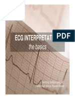 ECG Interpretation