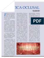 Plástica Oclusal