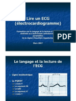 Lire Un ECG