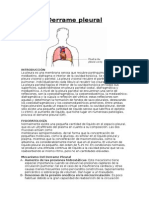 Derrame Pleural - Oinforme