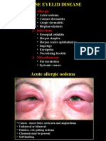 03diffuse Eyelid Diseases