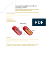 Limpia Los Vasos Sanguineos y Obstruccion de Las Arterias Con Este Simple Remedio