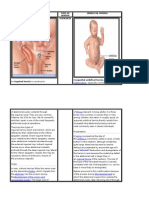 INGUINAL HERNIA and Umbilical Hernia