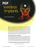 Wireless Implants