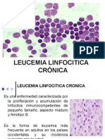  Leucemias Cronicas