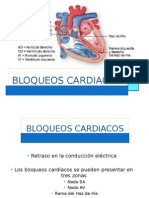 Bloqueos Ekg