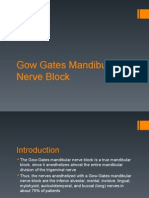 Mandibular Nerve Block