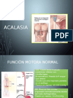 Acalasia