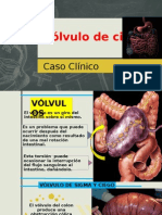 Vólvulo de Ciego