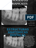 Radiografias Periapicales