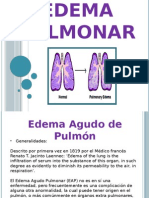 Diapos de Edema Pulmonar