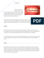 Hiperplasia Gingival