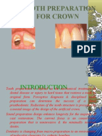 Tooth Preparation For Crown