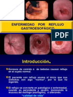 Enfermedad Por Reflujo Gastroesofagico