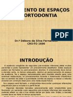 Fechamento de Espaços em Ortodontia