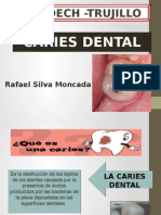 Caries Dental