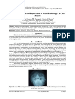 A Large Rhinolith and Importance of Nasal Endoscopy: A Case Report