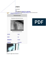 Clavicle Fracture