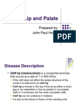 Cleft Lip and Palate