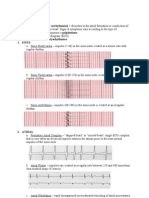 DYSRHYTHMIAS (A.k.a. Arrhythmias) Disorders in The