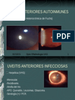 Uveitis 2