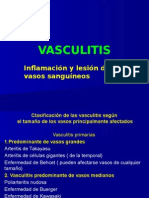 Vasculitis PowerNUEVO