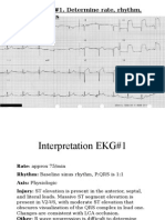 EKG Self Study Guide