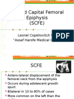 Slipped Capital Femoral Epiphysis