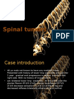 Spinal Tumors