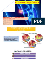 Adenocarcinoma de Próstata