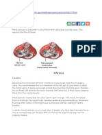 Mitral Stenosis: From