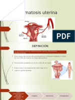 Miomatosis Uterina