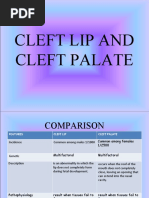 Cleft Lip and Cleft Palate