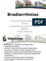 Bradiarritmias