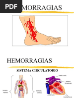 Hemorragias