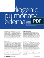 Pulmonary Edema 