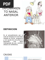 Taponamiento Nasal Anterior