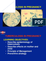 5.tuberculosis in Pregnancy