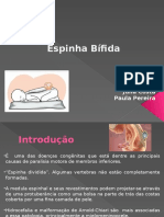 Espinha Bifida