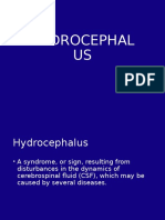 Hydrocephalus