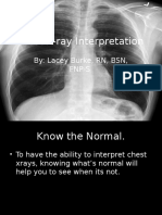 Chest Xray Interpretation