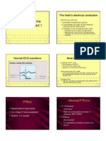 Understanding The 12 - Lead ECG, Part 1