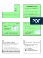 Understanding The 12 - Lead ECG, Part II