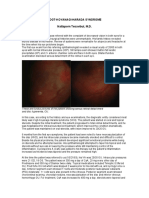 Vogt Koyanagi Harada Syndrome