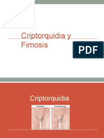 Criptorquidia y Fimosis