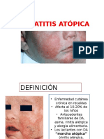 Dermatitis Atópica y Seborreica