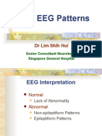 EEG Lecture Normal EEGs