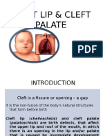 Cleft Lip & Palate